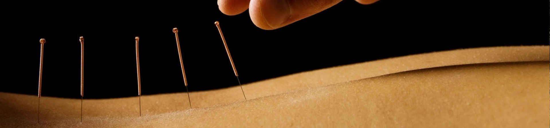 Medicina Alternativa y/o Complementaria Medicina Alternativa y/o Complementaria